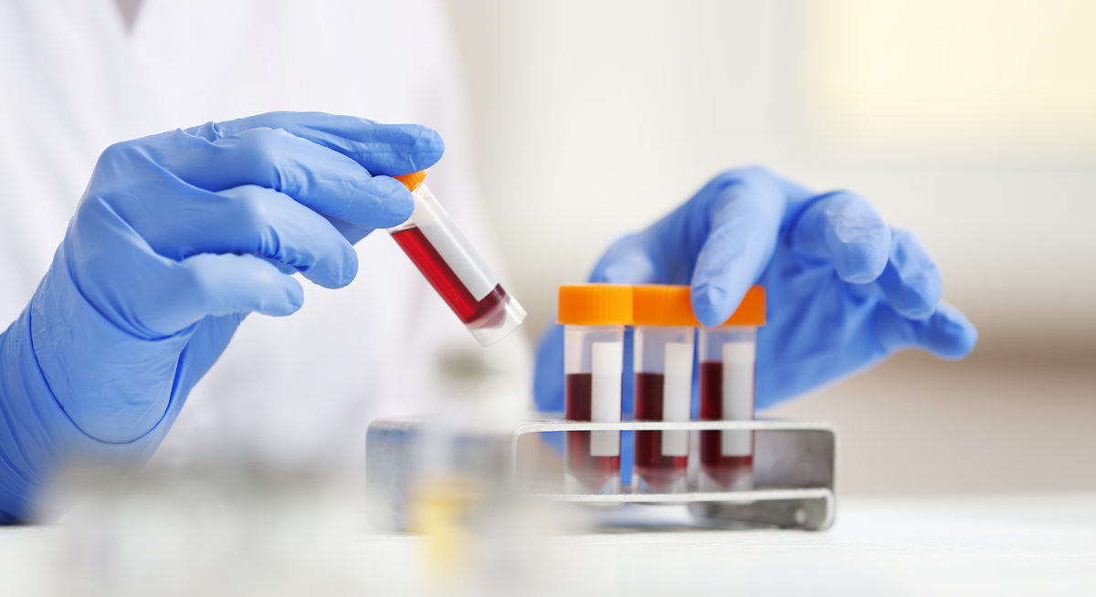 Blood test