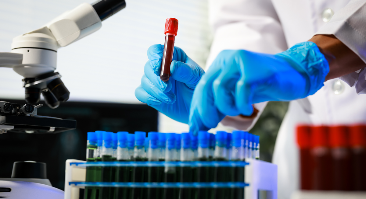 Blood test